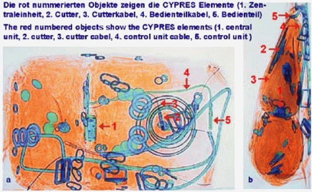 Карточка показывает как выглядит система с CYPRES 2 в рентгеновских лучах